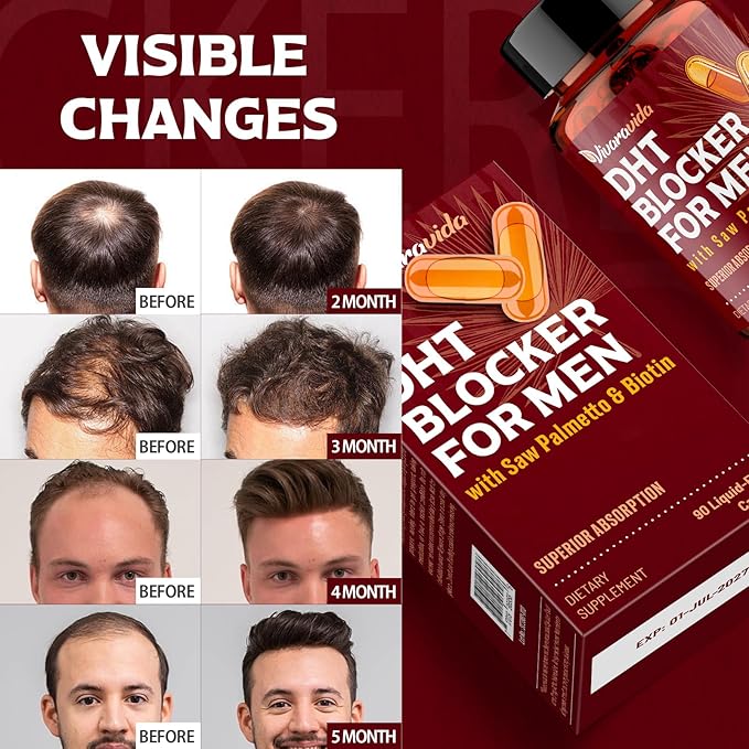 DHT Blocker for Men | Hair Growth Supplement with Saw Palmetto & Biotin - Hair Growth Vitamins - Hair Regrowth - Natural Hair Loss Supplements Liquid-Filled - Proprietary Herbal Blends (90 Capsules)