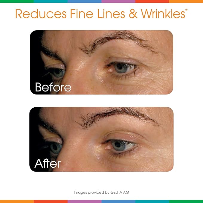 Sparkle Skin Boost (Orange) [30-Serves] (3-Pack) 3X 4.4oz 4.4oz